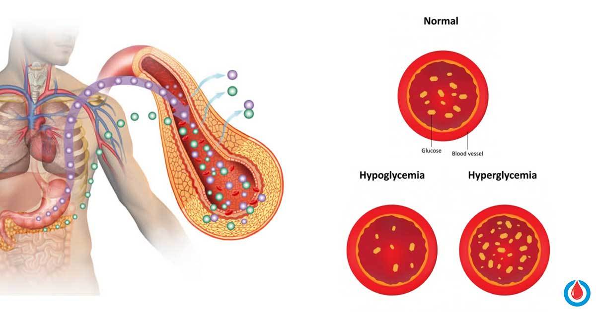 the-difference-between-hyperglycemia-and-hypoglycemia-and-what-to-do