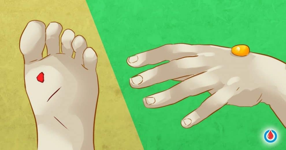 13 Signs of Skin Conditions Caused by Diabetes and How to Prevent Them