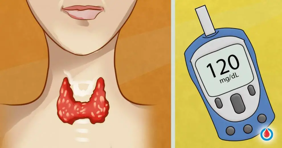 How High Glucose Levels Affect Your Thyroid