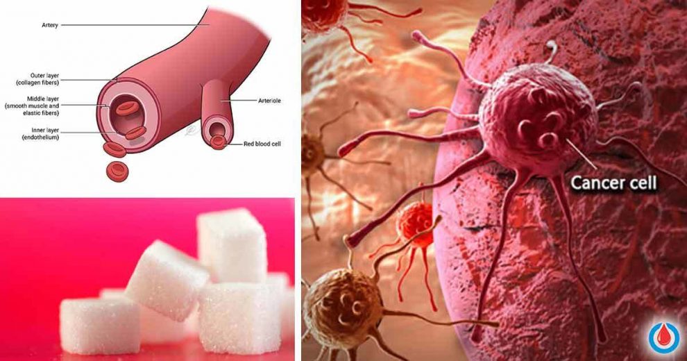 How to Control Your Blood Sugar Levels to Avoid Being Prone to Cancer