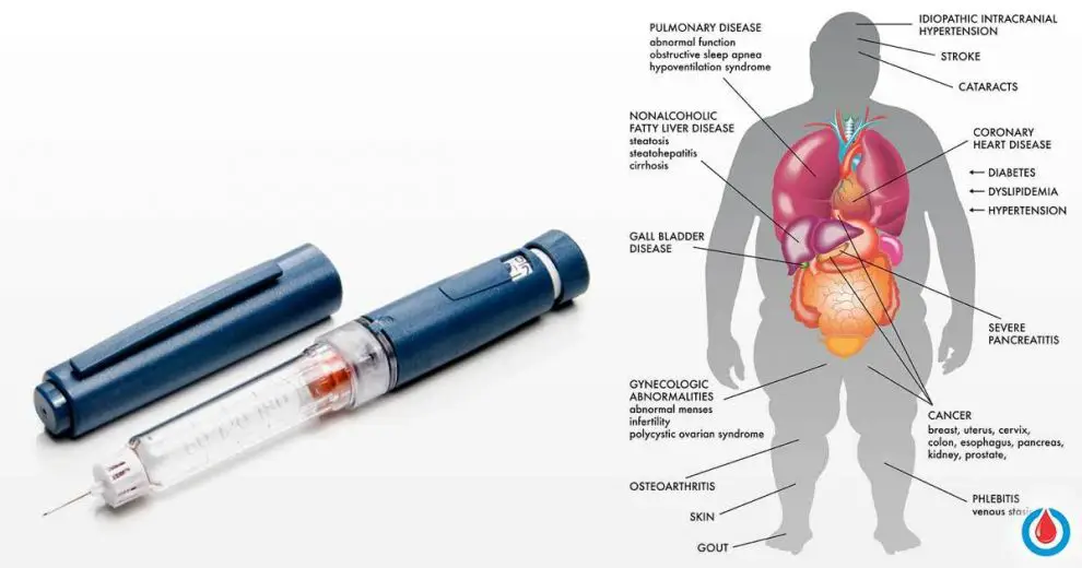 Insulin Resistance – What It Is and What to Do About It