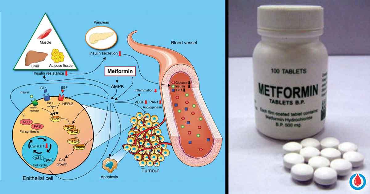 side effect of metformin