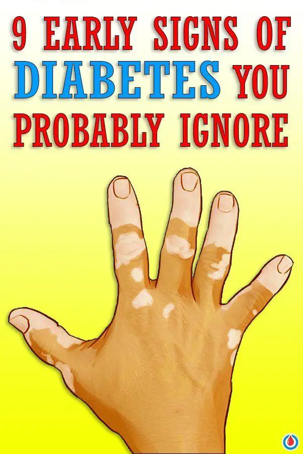 An illustration of a palm affected by diabetes with text overlay - 9 early signs of diabetes you probably ignore.