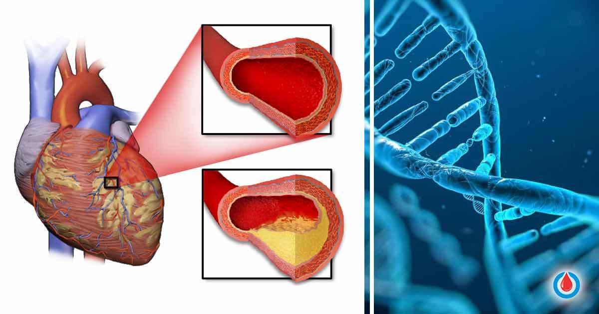 What Scientists Say About the Link Between Diabetes and Heart Disease