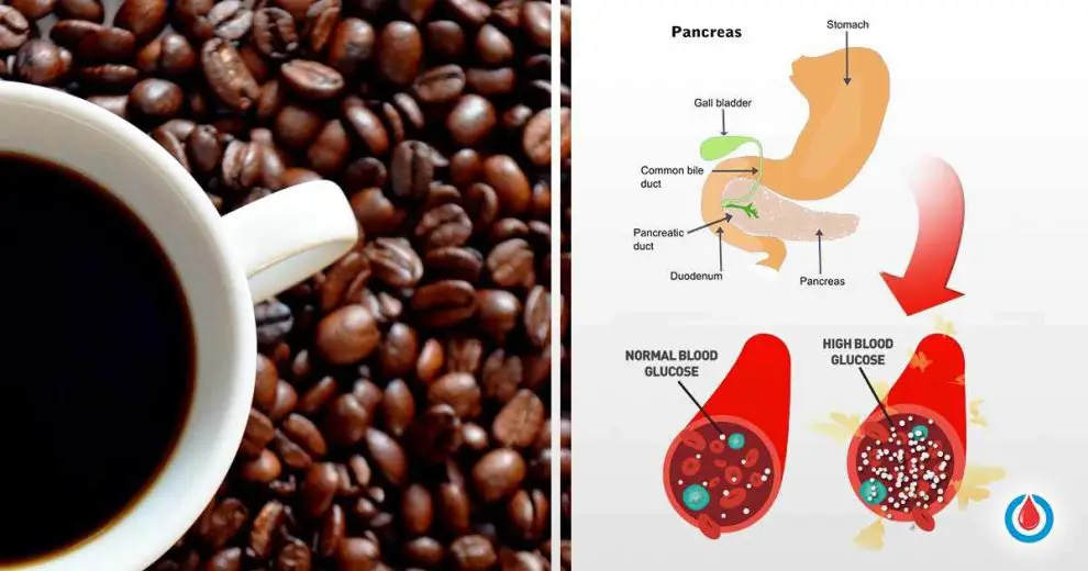 How Does Caffeine Affect Blood Sugar and Diabetes?
