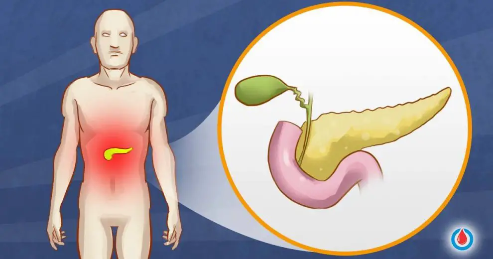 What Role Does the Pancreas Play in Diabetes?