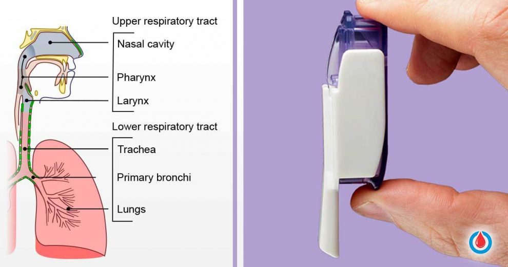 Things You Must Know Before Taking Inhalable Insulin