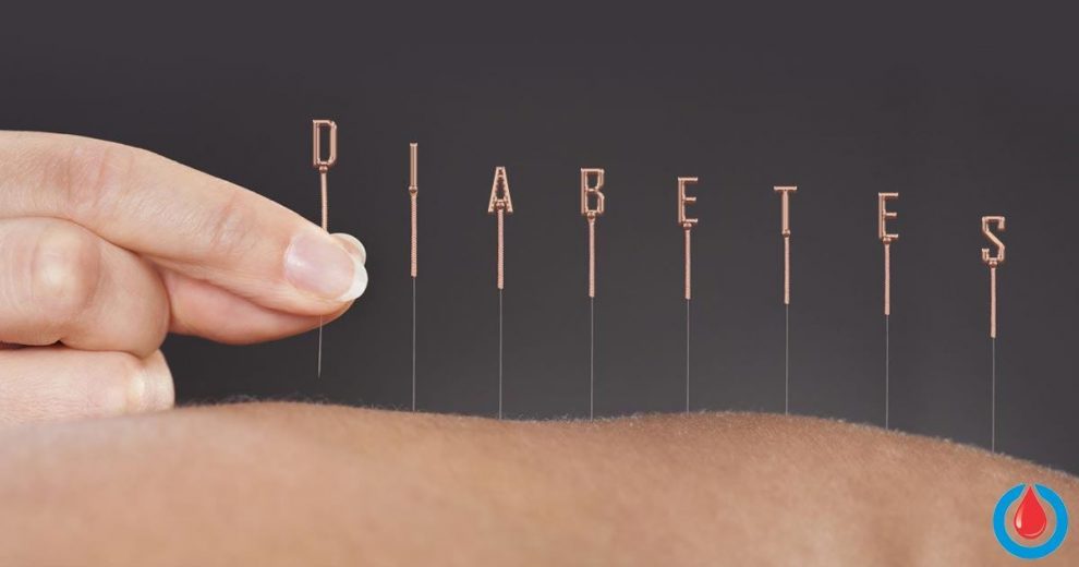 3 Acupuncture Techniques That Can Help Treat Diabetes