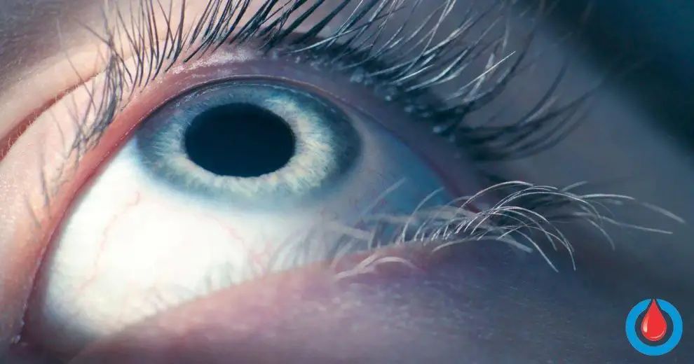 How Artificial Intelligence Can Detect Diabetic Eye Disease