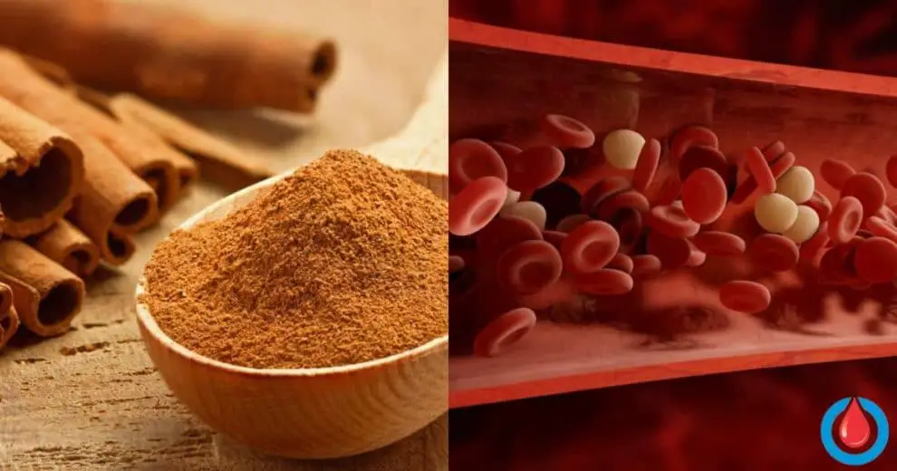 When Should People with Diabetes Avoid Cinnamon