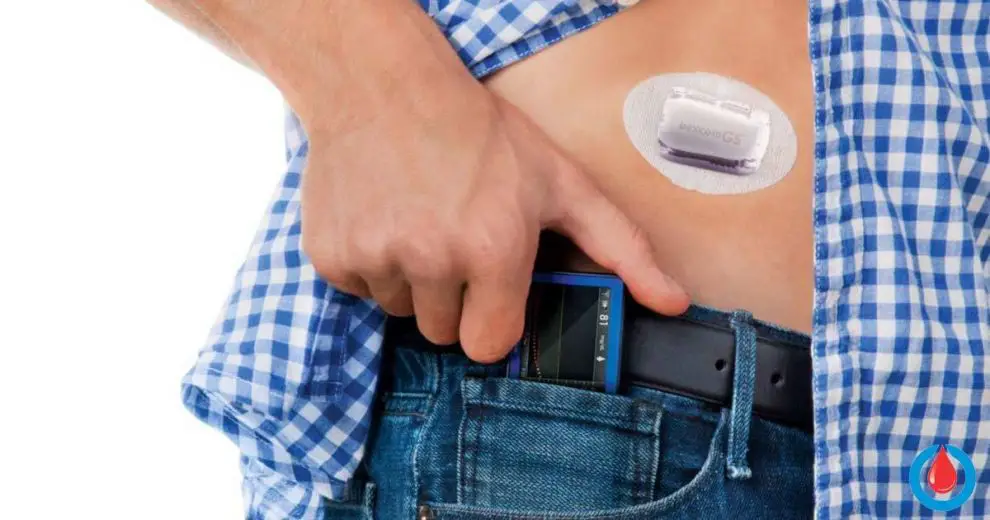 DexCom and Lilly Are Joining for the Better of All People with Diabetes