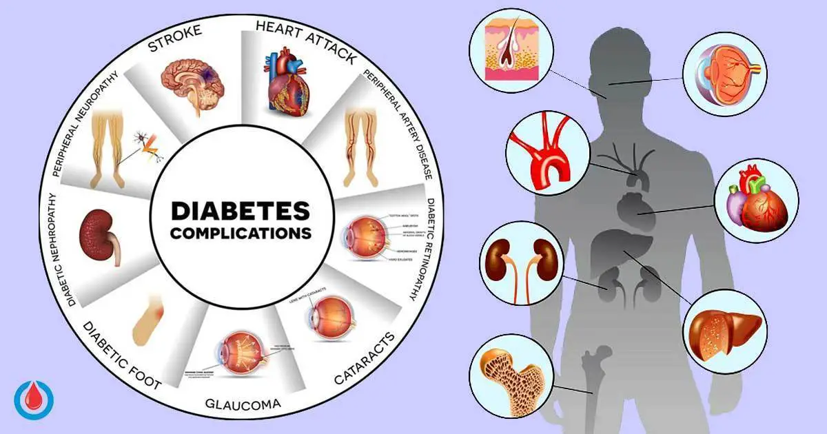 This Is How Diabetes Affects the Body