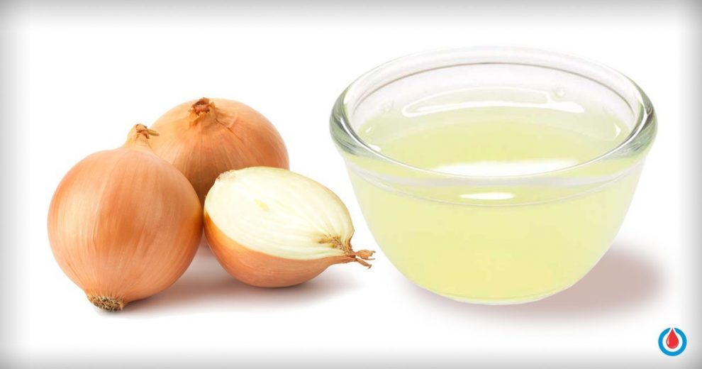 Surprising Benefits of Onion Extract for Blood Sugar and Cholesterol