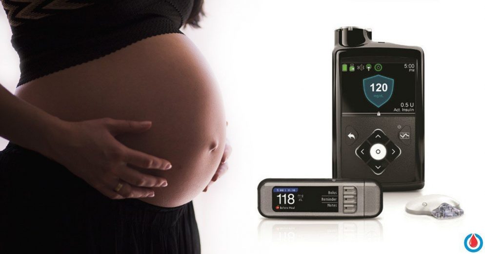 An Incredible Breakthrough for Pregnant Women with Diabetes