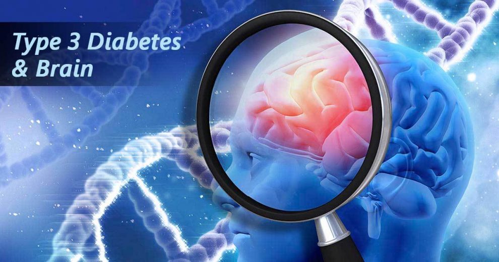 The Link Between Alzheimer’s and Diabetes You Must Know