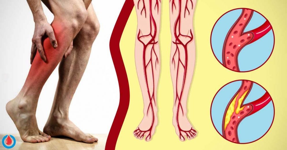 What Causes Muscle Cramps All Over the Body