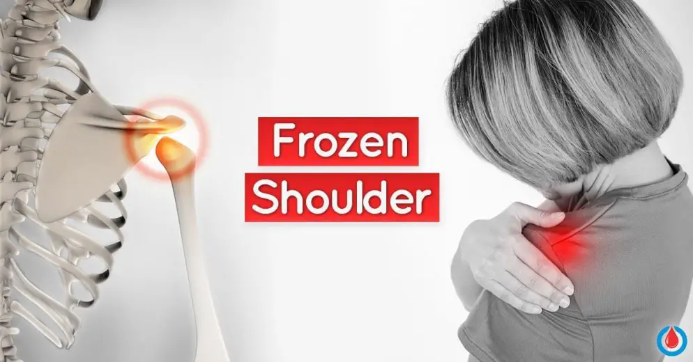 Frozen Shoulder and Diabetes - Are Both Conditions Connected