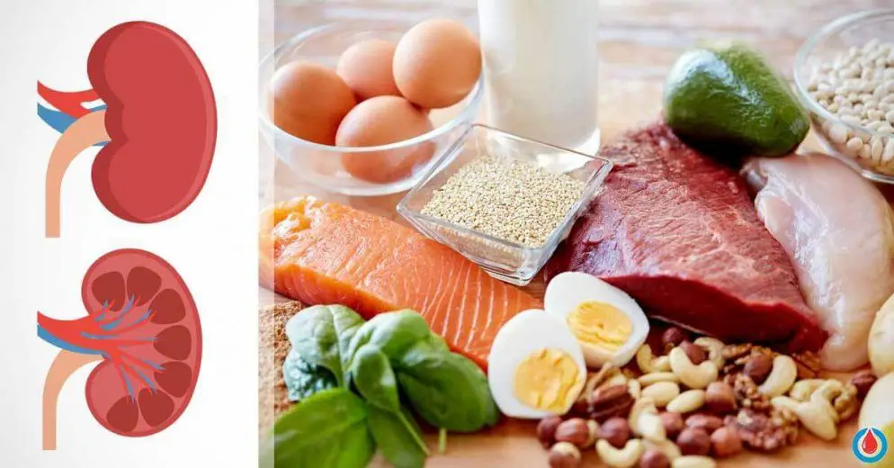 What Happens If You Have Excess Proteins in the Kidneys