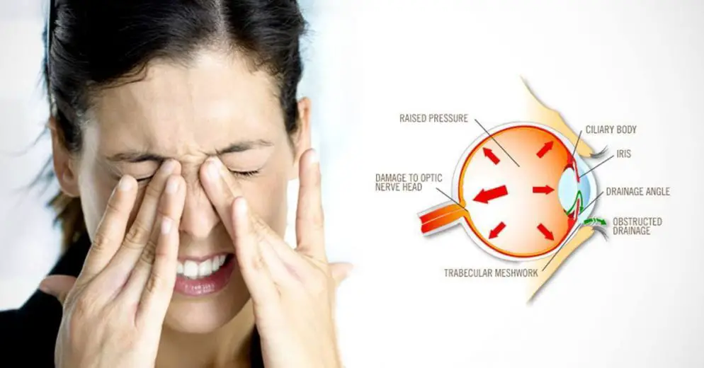 Who's at Risk for High Eye Pressure and How to Reduce It